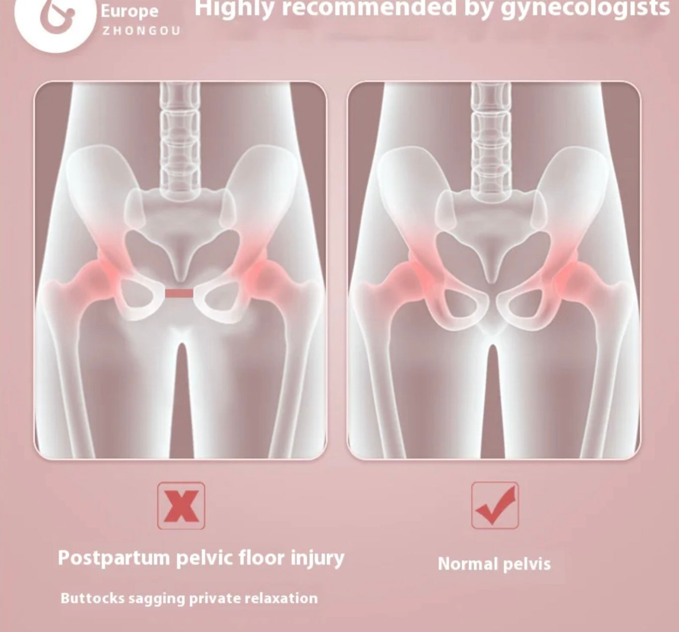 Pelvic Floor Muscle Trainer